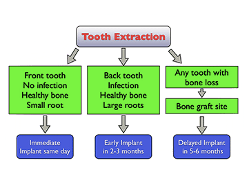 tooth-extraction-implant-timing